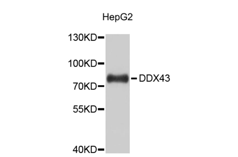 Western Blot - Anti-DDX43 Antibody (A9281) - Antibodies.com