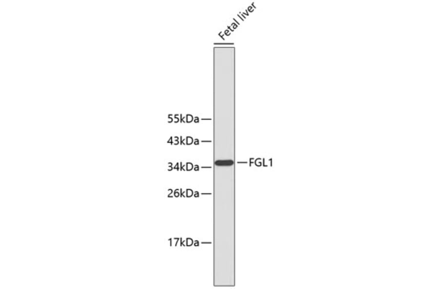 Western Blot - Anti-FGL1 Antibody (A10977) - Antibodies.com