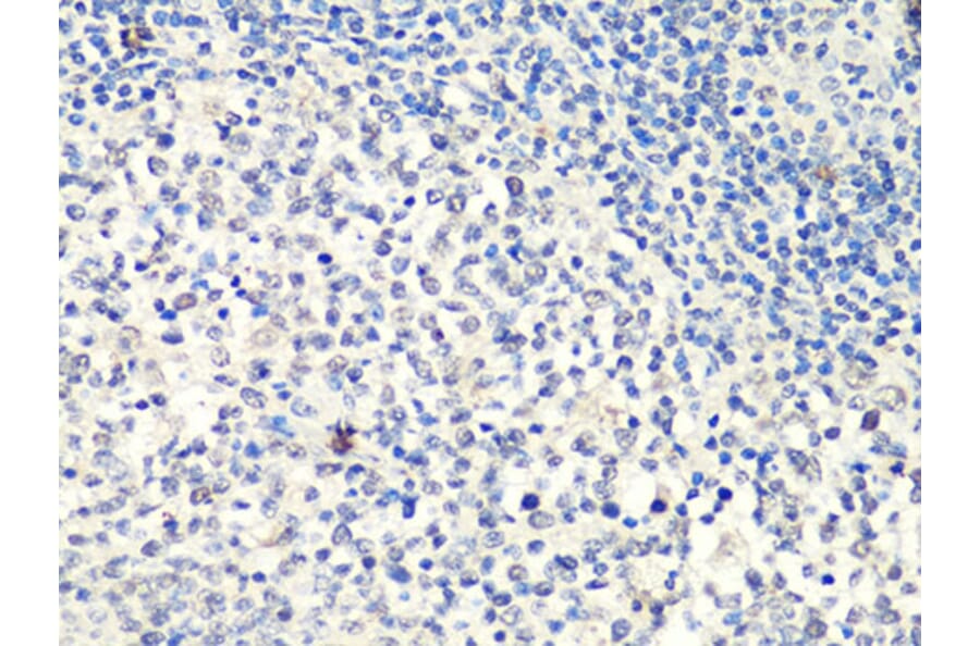 Immunohistochemistry - Anti-MTA2 Antibody (A10980) - Antibodies.com