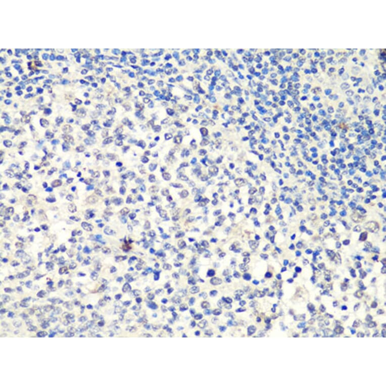 Immunohistochemistry - Anti-MTA2 Antibody (A10980) - Antibodies.com