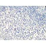 Immunohistochemistry - Anti-MTA2 Antibody (A10980) - Antibodies.com