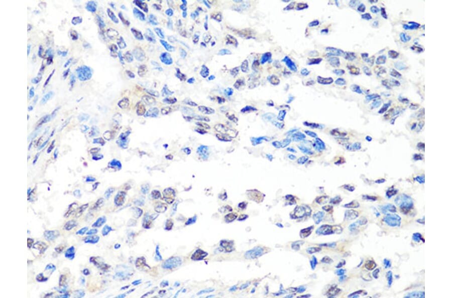 Immunohistochemistry - Anti-MTA2 Antibody (A10980) - Antibodies.com