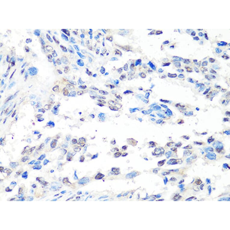 Immunohistochemistry - Anti-MTA2 Antibody (A10980) - Antibodies.com