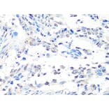 Immunohistochemistry - Anti-MTA2 Antibody (A10980) - Antibodies.com