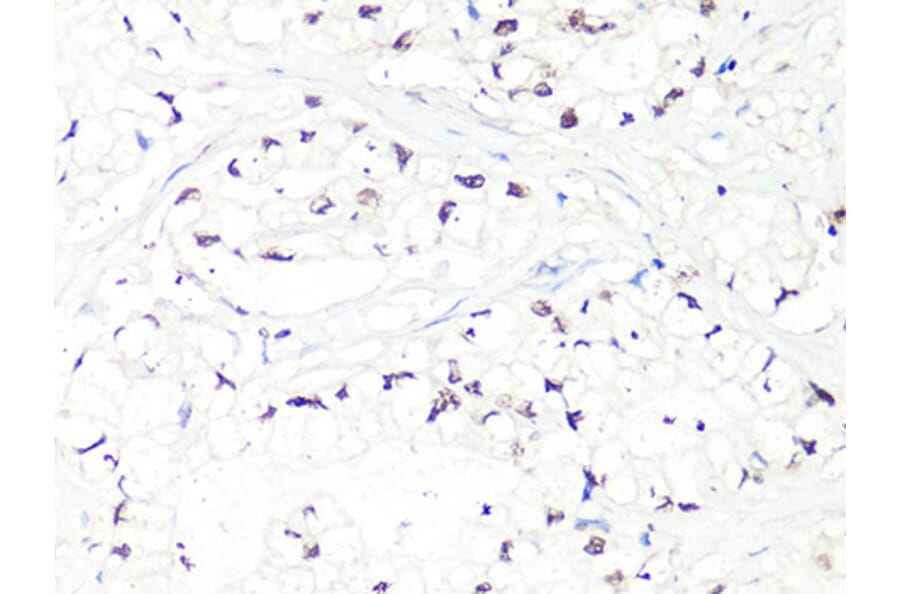 Immunohistochemistry - Anti-MTA2 Antibody (A10980) - Antibodies.com
