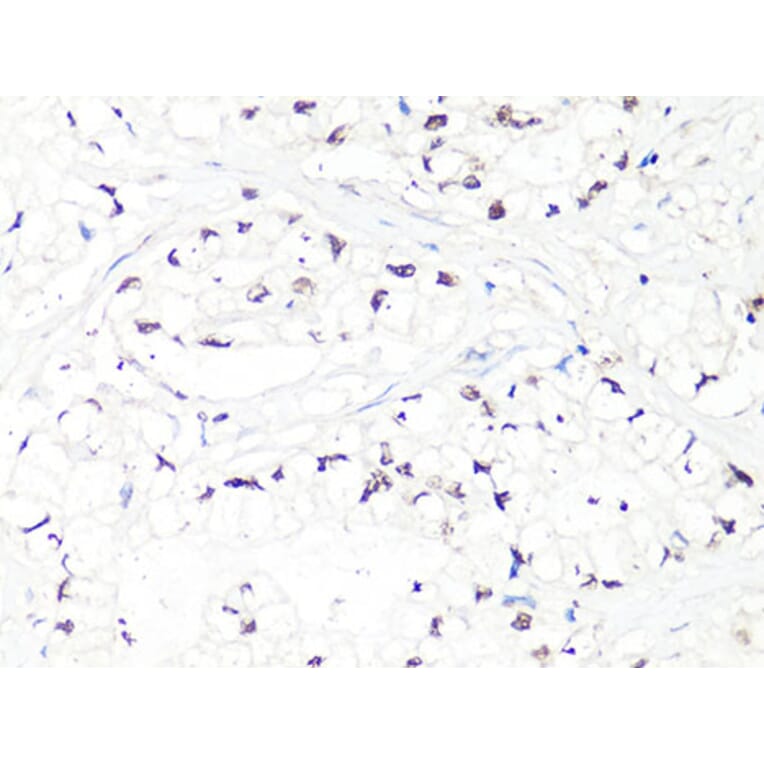 Immunohistochemistry - Anti-MTA2 Antibody (A10980) - Antibodies.com