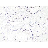 Immunohistochemistry - Anti-MTA2 Antibody (A10980) - Antibodies.com