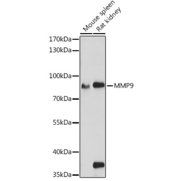 Western Blot - Anti-MMP9 Antibody (A80528) - Antibodies.com
