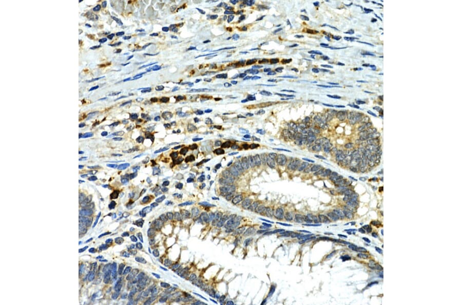 Immunohistochemistry - Anti-MMP9 Antibody (A80528) - Antibodies.com