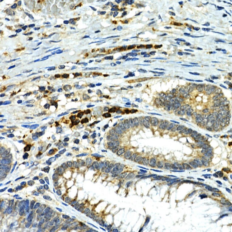 Immunohistochemistry - Anti-MMP9 Antibody (A80528) - Antibodies.com