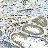 Immunohistochemistry - Anti-MMP9 Antibody (A80528) - Antibodies.com