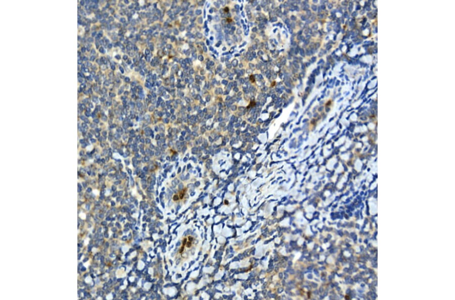 Immunohistochemistry - Anti-MMP9 Antibody (A80528) - Antibodies.com