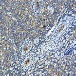 Immunohistochemistry - Anti-MMP9 Antibody (A80528) - Antibodies.com