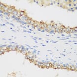 Immunohistochemistry - Anti-PTEN Antibody (A80529) - Antibodies.com