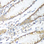 Immunohistochemistry - Anti-PTEN Antibody (A80529) - Antibodies.com