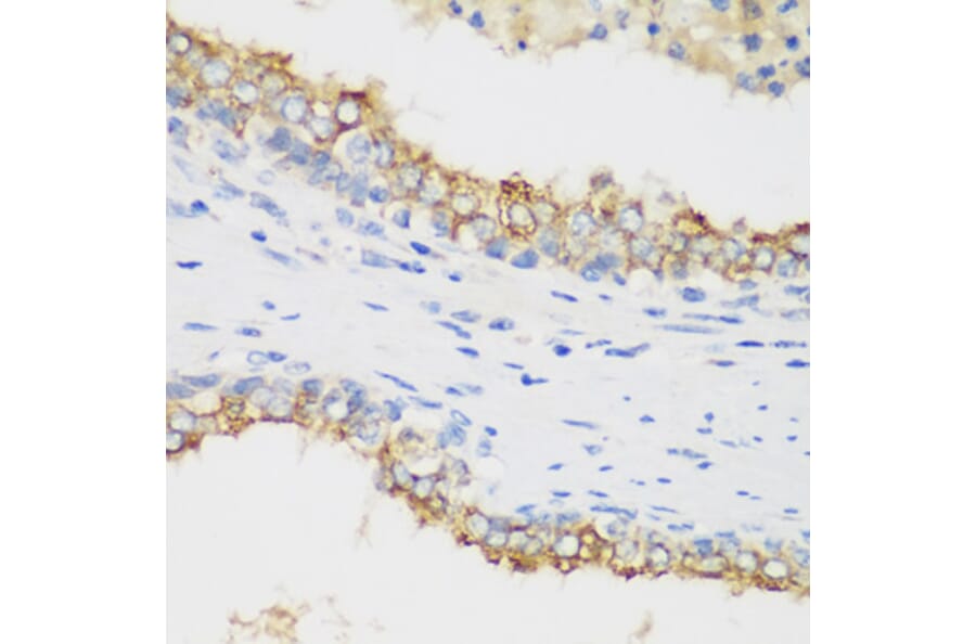 Immunohistochemistry - Anti-PTEN Antibody (A80529) - Antibodies.com