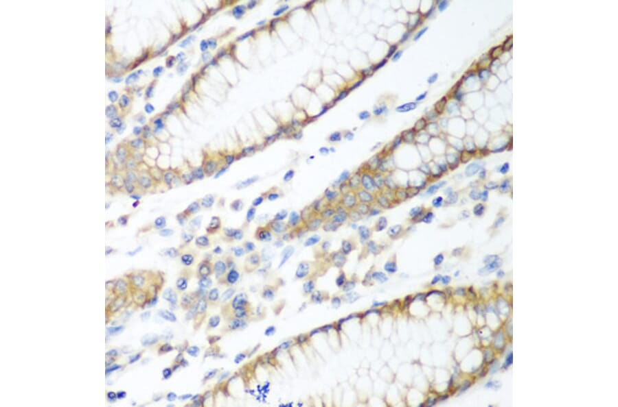 Immunohistochemistry - Anti-PTEN Antibody (A80529) - Antibodies.com