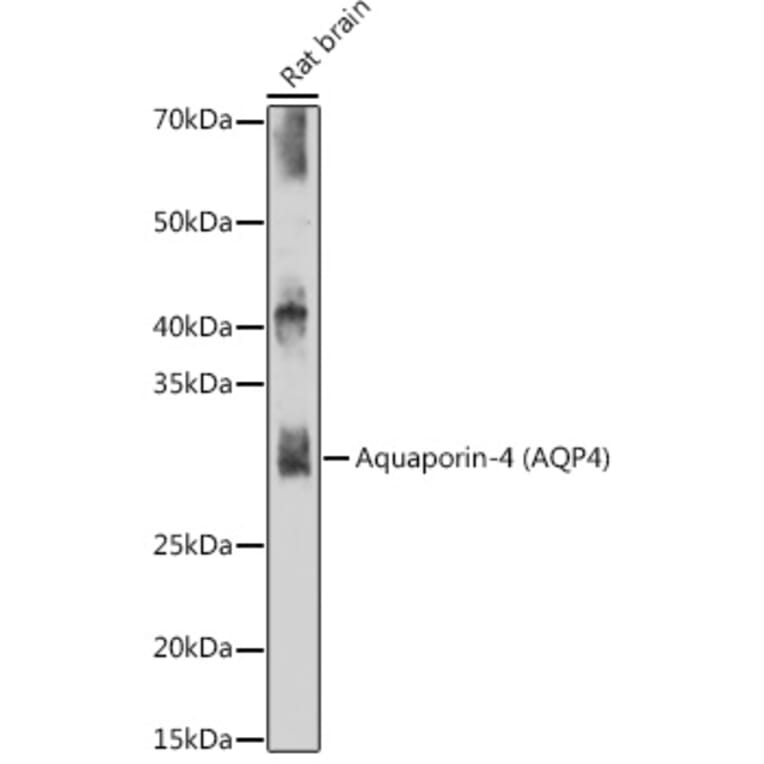 Western Blot - Anti-Aquaporin 4 Antibody [ARC54345] (A80530) - Antibodies.com