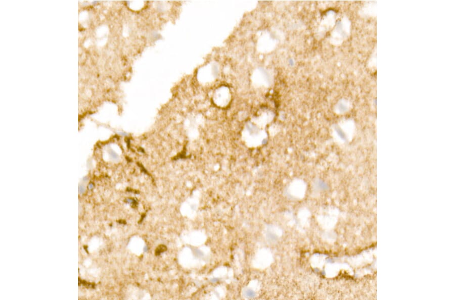 Immunohistochemistry - Anti-Aquaporin 4 Antibody [ARC54345] (A80530) - Antibodies.com