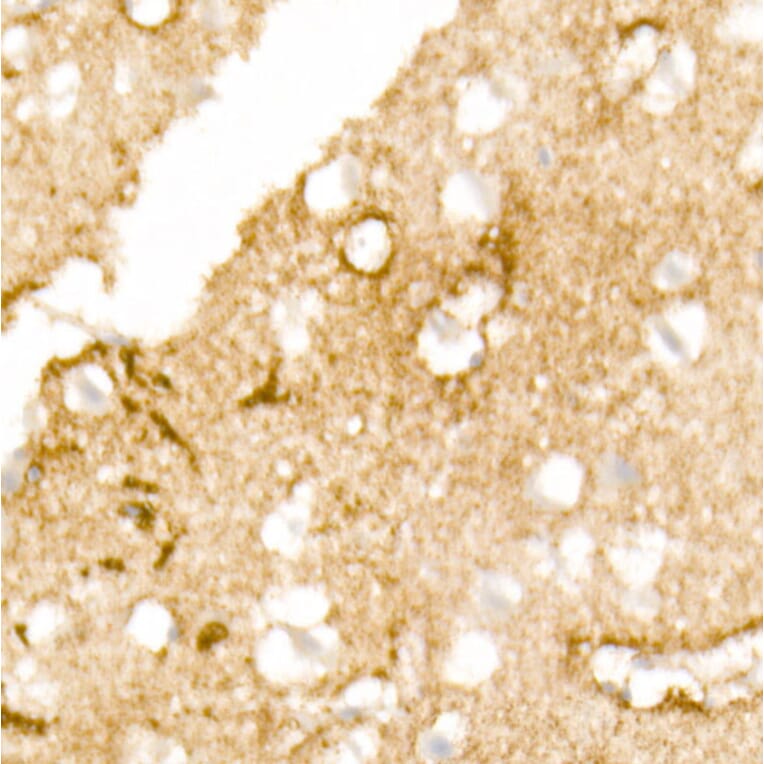 Immunohistochemistry - Anti-Aquaporin 4 Antibody [ARC54345] (A80530) - Antibodies.com