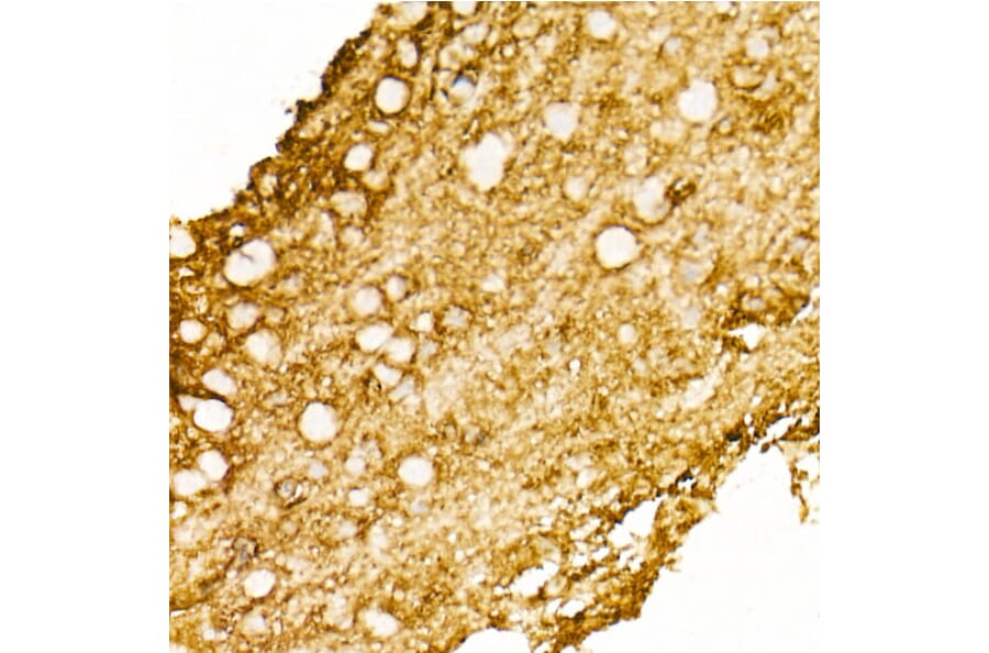 Immunohistochemistry - Anti-Aquaporin 4 Antibody [ARC54345] (A80530) - Antibodies.com