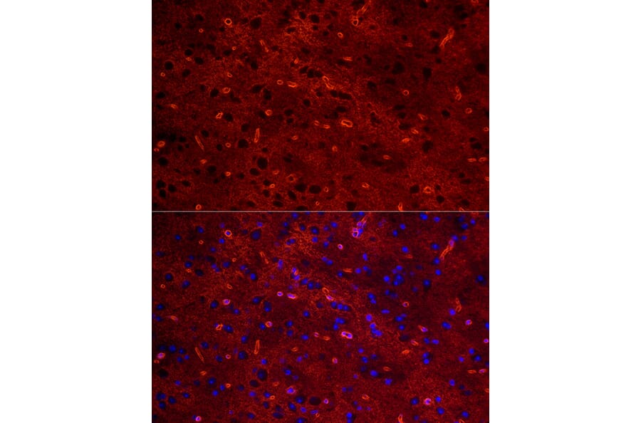 IHC of mouse brain using anti-AQP4 [ARC54345] Antibody (A80530)