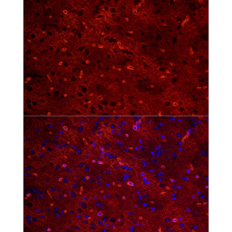 Immunofluorescence - Anti-Aquaporin 4 Antibody [ARC54345] (A80530) - Antibodies.com