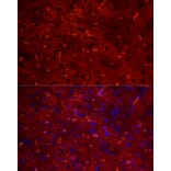 Immunofluorescence - Anti-Aquaporin 4 Antibody [ARC54345] (A80530) - Antibodies.com