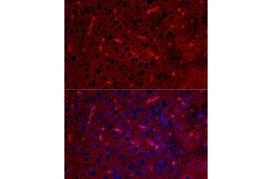 Immunofluorescence - Anti-Aquaporin 4 Antibody [ARC54345] (A80530) - Antibodies.com