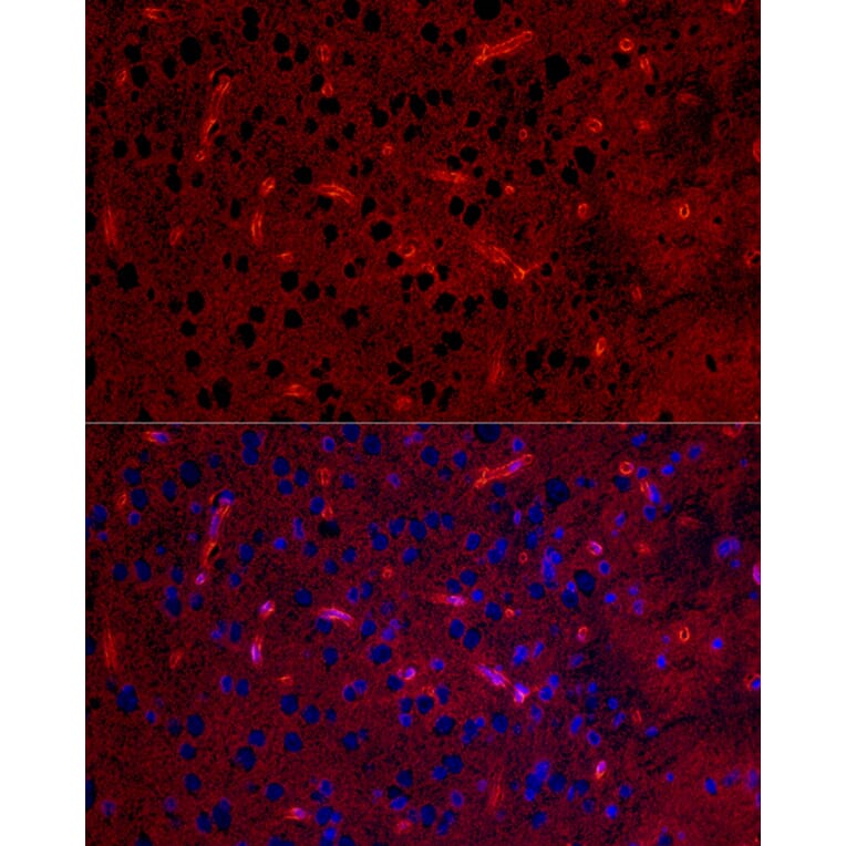 Immunofluorescence - Anti-Aquaporin 4 Antibody [ARC54345] (A80530) - Antibodies.com