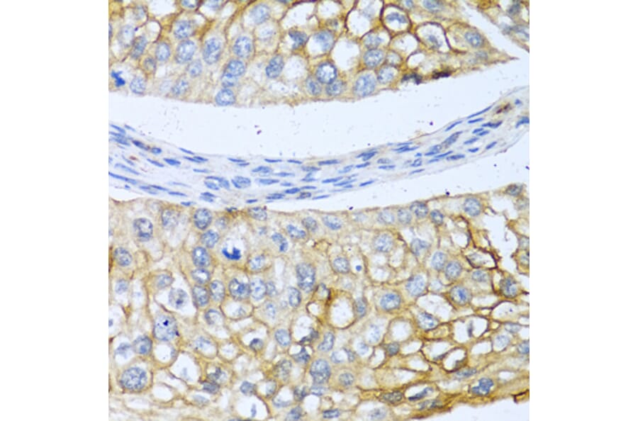 Immunohistochemistry - Anti-BMP4 Antibody (A80532) - Antibodies.com
