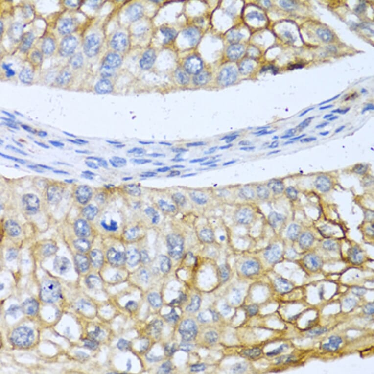 Immunohistochemistry - Anti-BMP4 Antibody (A80532) - Antibodies.com