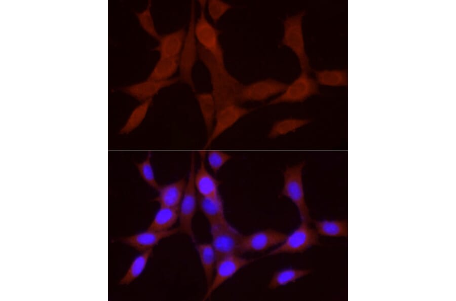 Immunofluorescence - Anti-BMP4 Antibody (A80532) - Antibodies.com