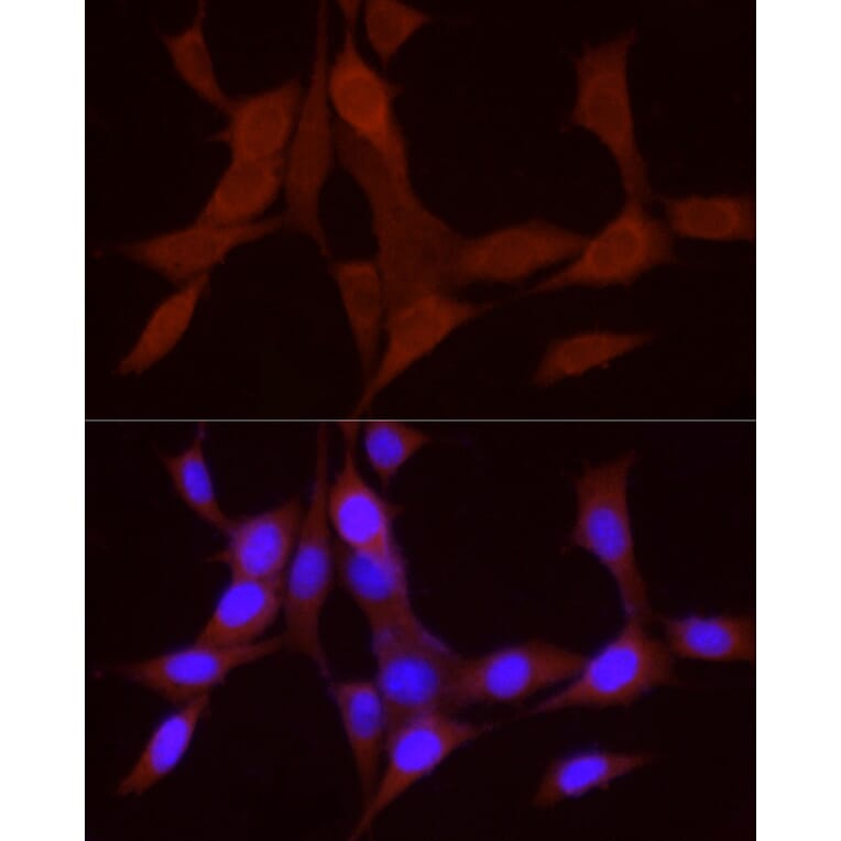 Immunofluorescence - Anti-BMP4 Antibody (A80532) - Antibodies.com