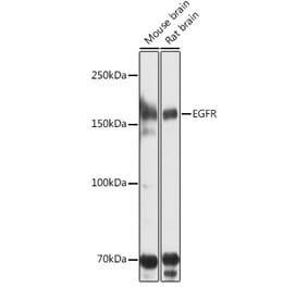 Western Blot - Anti-EGFR Antibody (A80534) - Antibodies.com