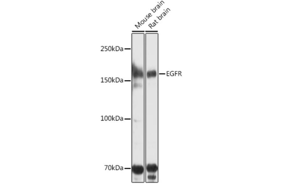 Western Blot - Anti-EGFR Antibody (A80534) - Antibodies.com