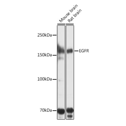 Western Blot - Anti-EGFR Antibody (A80534) - Antibodies.com