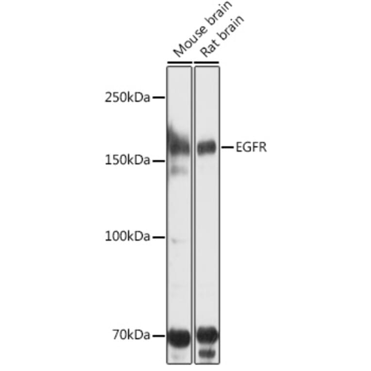 Western Blot - Anti-EGFR Antibody (A80534) - Antibodies.com
