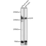 Western Blot - Anti-EGFR Antibody (A80534) - Antibodies.com
