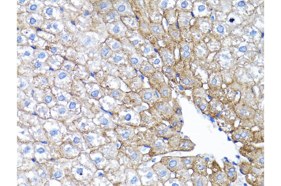 Immunohistochemistry - Anti-EGFR Antibody (A80534) - Antibodies.com