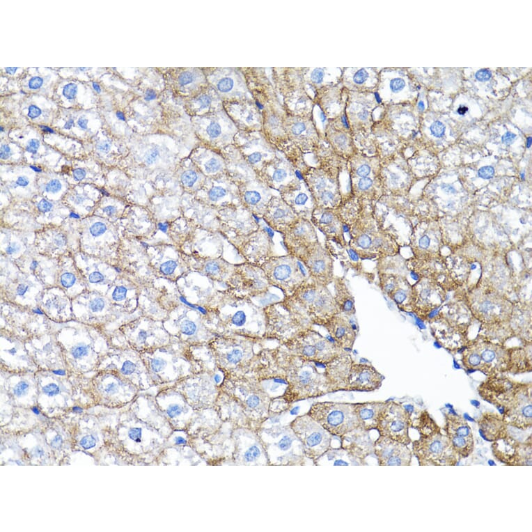 Immunohistochemistry - Anti-EGFR Antibody (A80534) - Antibodies.com