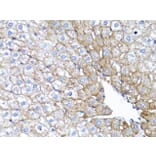Immunohistochemistry - Anti-EGFR Antibody (A80534) - Antibodies.com
