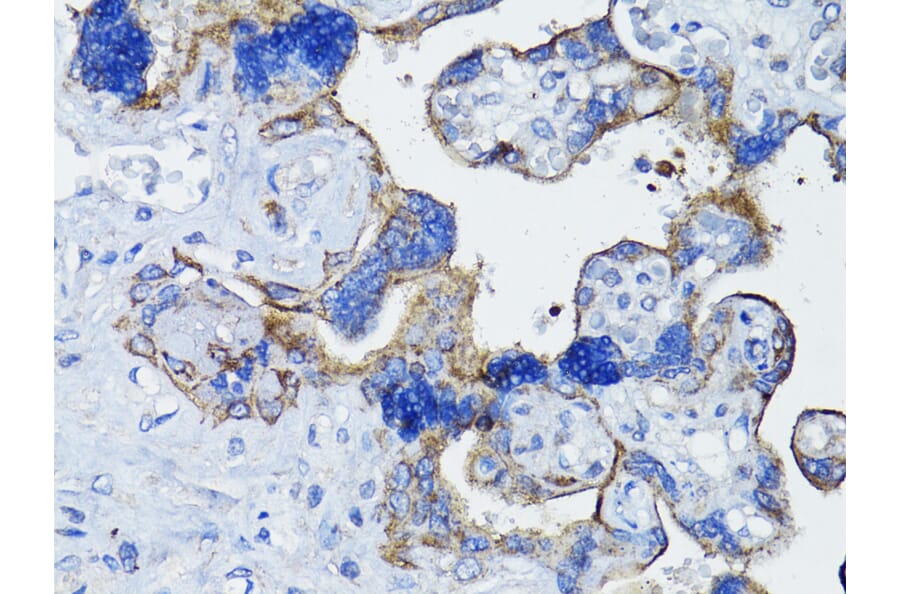 Immunohistochemistry - Anti-EGFR Antibody (A80534) - Antibodies.com