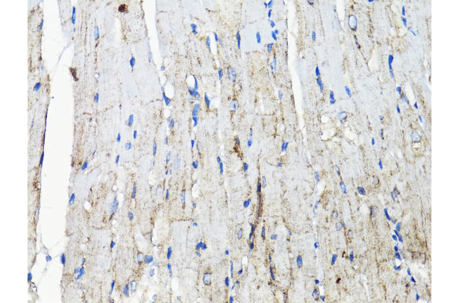 Immunohistochemistry - Anti-EGFR Antibody (A80534) - Antibodies.com