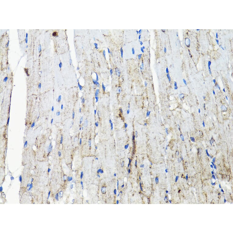 Immunohistochemistry - Anti-EGFR Antibody (A80534) - Antibodies.com