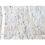 Immunohistochemistry - Anti-EGFR Antibody (A80534) - Antibodies.com