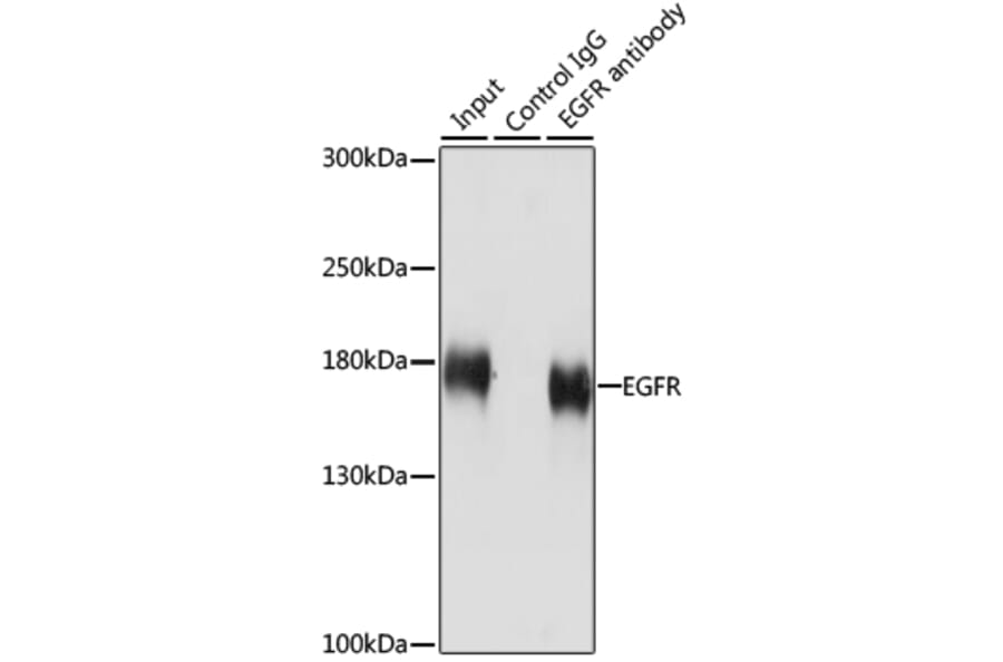 Western Blot - Anti-EGFR Antibody (A80534) - Antibodies.com