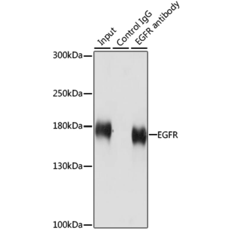 Western Blot - Anti-EGFR Antibody (A80534) - Antibodies.com