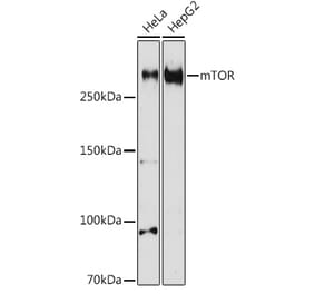 Western Blot - Anti-mTOR Antibody (A80535) - Antibodies.com