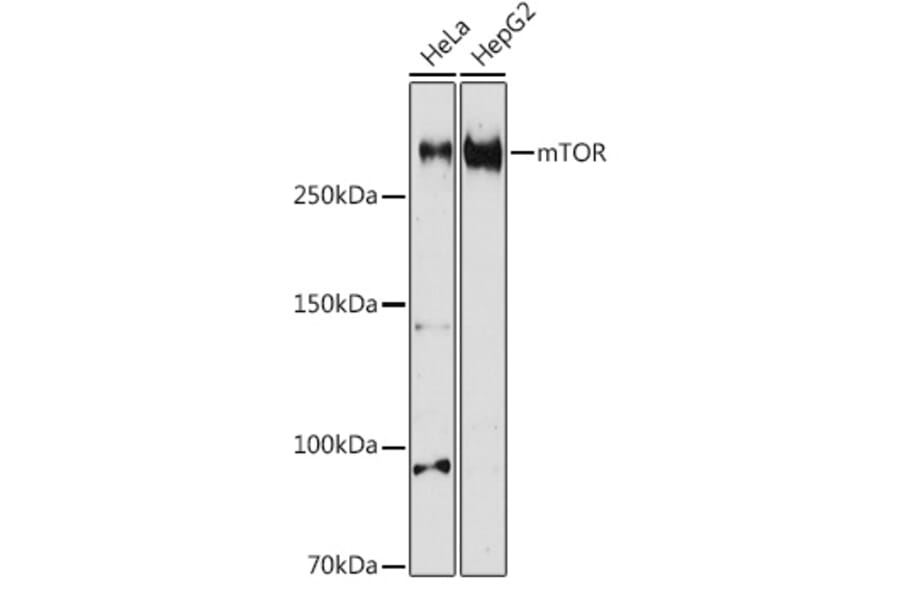 Western Blot - Anti-mTOR Antibody (A80535) - Antibodies.com